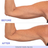 SculptSkin™ - Voor een Stevige, Gladde Huid Zonder Gedoe - Yoova