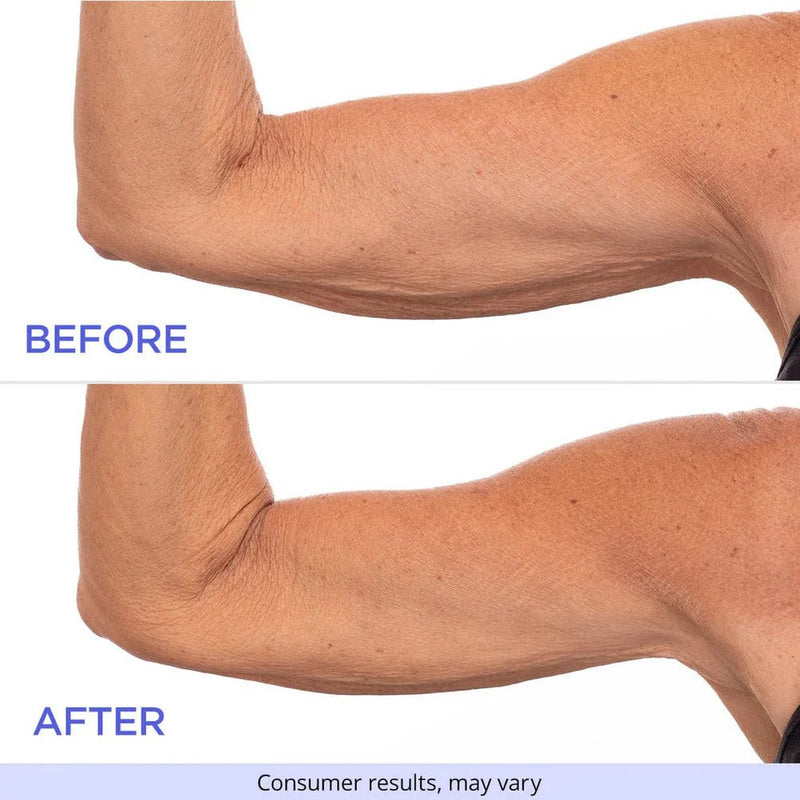 SculptSkin™ - Voor een Stevige, Gladde Huid Zonder Gedoe - Yoova