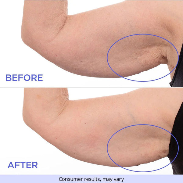 SculptSkin™ - Voor een Stevige, Gladde Huid Zonder Gedoe - Yoova