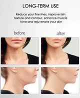 Skinlift™ - Dé oplossing voor een strakke en gezonde huid! - Yoova
