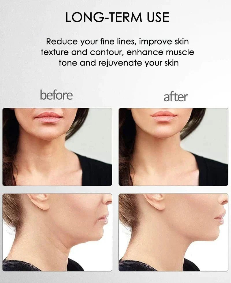 Skinlift™ - Dé oplossing voor een strakke en gezonde huid! - Yoova